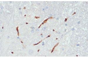 Immunohistochemistry of paraffin-embedded Mouse spinal cord using Phospho-eNOS(S1177) Polyclonal Antibody at dilution of 1:200 (40x lens).