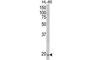 Western blot analysis of NDUFS4 Antibody (C-term) in HL-60 cell line lysates (35ug/lane). (NDUFS4 Antikörper  (C-Term))