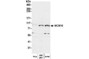 anti-Minichromosome Maintenance Deficient 10 (MCM10) (AA 600-650) antibody