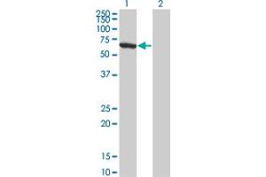 Western Blot analysis of WDR20 expression in transfected 293T cell line by WDR20 monoclonal antibody (M01), clone 1D10.