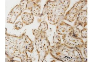 Immunoperoxidase of monoclonal antibody to CHEK2 on formalin-fixed paraffin-embedded human placenta. (CHEK2 Antikörper  (AA 1-543))