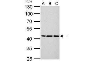 WB Image Cytokeratin 14 antibody detects KRT14 protein by Western blot analysis. (KRT14 Antikörper)