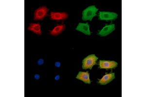 anti-Fer-1-Like 5 (FER1L5) antibody