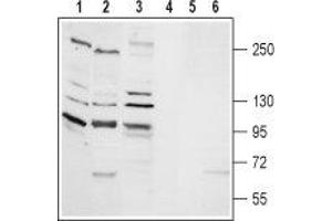 Western blot analysis of rat lung membrane (lanes 1 and 4), rat brain membrane (lanes 2 and 5) and human K562 chronic myelogeneous cells (lanes 3 and 6) lysates: - 1-3.