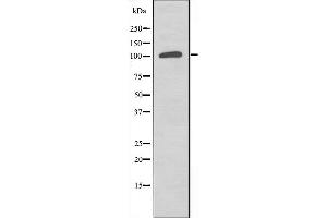 Western blot analysis of extracts from COLO205 cells, using ST5 antibody. (ST5 Antikörper  (Internal Region))