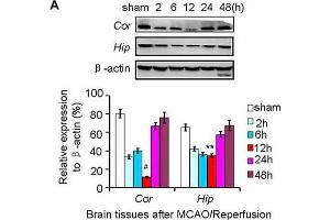Nurr1 expression at 2, 6, 12, 24 and 48 h after MCAO/R. (beta Actin Antikörper)