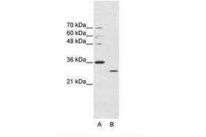 Image no. 1 for anti-ATPase, Cu++ Transporting, alpha Polypeptide (ATP7A) (C-Term) antibody (ABIN203040) (ATP7A Antikörper  (C-Term))