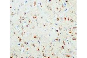 Immunohistochemical analysis of paraffin-embedded rat brain sections, stain NGF in cytoplasm DAB chromogenic reaction. (Nerve Growth Factor Antikörper  (C-Term))
