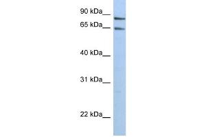 WB Suggested Anti-PPP1R10 Antibody Titration:  0. (PPP1R10 Antikörper  (N-Term))