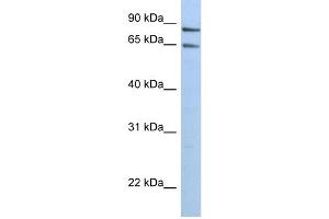 WB Suggested Anti-PPP1R10 Antibody Titration:  0.