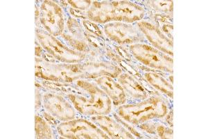 Immunohistochemistry of paraffin-embedded rat kidney using GPS1 Rabbit pAb (ABIN6127934, ABIN6141361, ABIN6141362 and ABIN6222653) at dilution of 1:250 (40x lens). (GPS1 Antikörper  (AA 258-527))