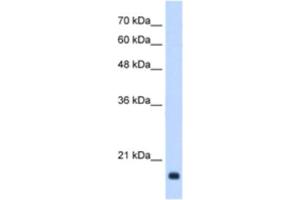 Western Blotting (WB) image for anti-Growth Arrest and DNA-Damage-Inducible, beta (GADD45B) antibody (ABIN2463174)