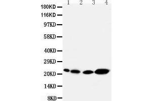 Anti-Caveolin-2 antibody, Western blotting Lane 1: Rat Heart Tissue Lysate Lane 2: Rat lung Tissue Lysate Lane 3: HELA Cell Lysate Lane 4: A431 Cell Lysate (Caveolin 2 Antikörper  (N-Term))