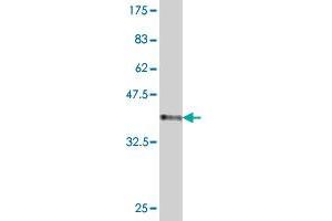 Western Blotting (WB) image for anti-TBC1 Domain Family, Member 8 (With GRAM Domain) (TBC1D8) (AA 1-110) antibody (ABIN524556)