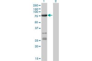 Western Blot analysis of ACSL5 expression in transfected 293T cell line by ACSL5 monoclonal antibody (M01), clone 5H8.