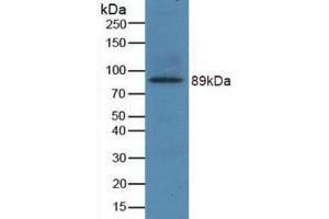 Detection of Recombinant GRIN2B, Human using Polyclonal Antibody to Glutamate Receptor, Ionotropic, N-Methyl-D-Aspartate 2B (GRIN2B) (GRIN2B Antikörper  (AA 35-557))