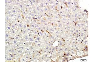 Formalin-fixed and paraffin embedded rat liver labeled with Anti-CD209 Polyclonal Antibody, Unconjugated (ABIN678893) at 1:200 followed by conjugation to the secondary antibody and DAB staining (DC-SIGN/CD209 Antikörper  (AA 81-180))