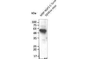 Western Blotting (WB) image for anti-SARS-CoV-2 Papain-Like Protease (NSP3) (C-Term) antibody (ABIN7272998) (SARS-CoV-2 NSP3 Antikörper  (C-Term))