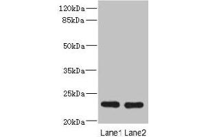Western blot All lanes: RAB17 antibody at 3. (RAB17 Antikörper  (AA 1-212))