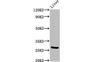 Western Blot Positive WB detected in: Mouse liver tissue All lanes: PIK3IP1 antibody at 7 μg/mL Secondary Goat polyclonal to rabbit IgG at 1/50000 dilution Predicted band size: 29, 26, 12, 19, 20 kDa Observed band size: 29 kDa (PIK3IP1 Antikörper  (AA 22-168))