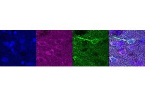 Immunohistochemistry (IHC) image for anti-Ubiquitin Carboxyl-terminal Esterase L1 (Ubiquitin Thiolesterase) (UCHL1) antibody (ABIN7456137) (UCHL1 Antikörper)