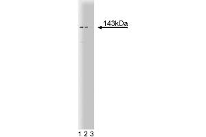 Western blot analysis of PEX1 on a HCT-8 cell lysate (Human colorectal adenocarcinoma, ATCC CCL-244). (PEX1 Antikörper  (AA 1049-1256))