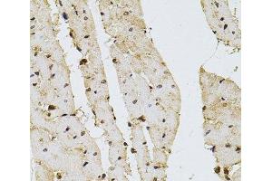 Immunohistochemistry of paraffin-embedded Rat heart using PPP2R5C Polyclonal Antibody at dilution of 1:100 (40x lens).