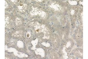 ABIN6261339 and ABIN6272656 at 1/100 staining human normal kidney tissue by IHC-P.