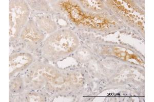 Immunoperoxidase of monoclonal antibody to S100A5 on formalin-fixed paraffin-embedded human kidney. (S100A5 Antikörper  (AA 1-90))