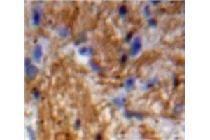 IHC-P analysis of Brain tissue, with DAB staining. (Neurotrophin 3 Antikörper  (AA 21-138))