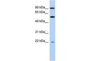 Image no. 1 for anti-Nuclear Receptor Subfamily 1, Group D, Member 2 (NR1D2) (AA 503-552) antibody (ABIN6742402)