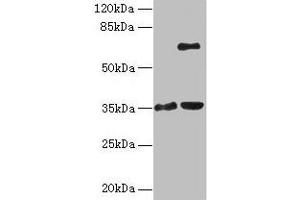 Western blot All lanes: ZNF75A antibody at 10 μg/mL Lane 1: Mouse brain tissue Lane 2: Mouse liver tissue Secondary Goat polyclonal to rabbit IgG at 1/10000 dilution Predicted band size: 35 kDa Observed band size: 35, 65 kDa (ZNF75A Antikörper  (AA 1-296))