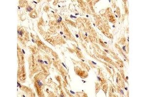 IHC analysis of FFPE human heart section using Integrin beta 8 antibody; Ab was diluted at 1:25. (ITGB8 Antikörper  (AA 197-231))
