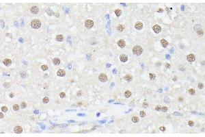 Immunohistochemistry of paraffin-embedded Rat liver using MLF2 Polyclonal Antibody at dilution of 1:100 (40x lens). (MLF2 Antikörper)