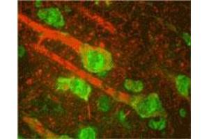 ADRBK1 monoclonal antibody, clone 5D5  (green) and neurofilament NF-M (red) staining, in rat cortex, showing mostly large pyramidal neurons.