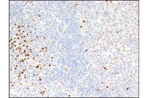 Immunohistochemistry using PIM2 mAb. (PIM2 Antikörper)