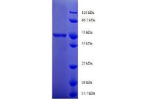 GM2 Ganglioside Activator (GM2A) (AA 32-193), (full length) protein (GST tag)