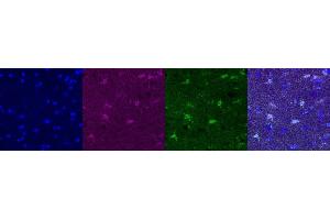 Immunohistochemistry (IHC) image for anti-Glutamate-Ammonia Ligase (GLUL) antibody (ABIN7456060) (GLUL Antikörper)