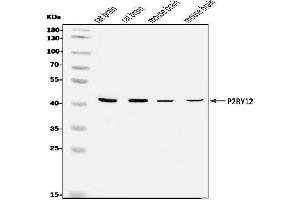 Western blot analysis of P2Y12/P2ry12 using anti-P2Y12/P2ry12 antibody (ABIN7603079).
