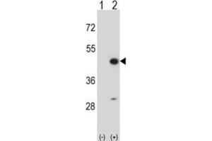 Western Blotting (WB) image for anti-Creatine Kinase, Mitochondrial 2 (Sarcomeric) (CKMT2) antibody (ABIN3002971) (CKMT2 Antikörper)