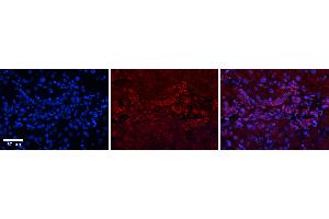 Rabbit Anti-GPD1 Antibody   Formalin Fixed Paraffin Embedded Tissue: Human Liver Tissue Observed Staining: Cytoplasm in bile ductule Primary Antibody Concentration: 1:100 Other Working Concentrations: N/A Secondary Antibody: Donkey anti-Rabbit-Cy3 Secondary Antibody Concentration: 1:200 Magnification: 20X Exposure Time: 0.