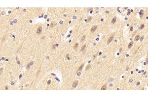 Detection of NRN1 in Porcine Cerebrum Tissue using Polyclonal Antibody to Neuritin 1 (NRN1)