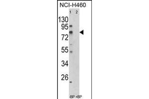 Western blot analysis of ACSS3 Antibody in NCI-H460 cell line lysates (35ug/lane)(2ug/ml) (ACSS3 Antikörper  (AA 224-251))