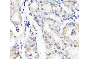 Immunohistochemistry of paraffin-embedded Human stomach using TBX20 Polyclonal Antibody at dilution of 1:100 (40x lens). (TBX20 Antikörper)