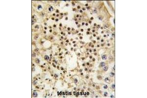 Formalin-fixed and paraffin-embedded human testis tissue reacted with LIN28A Monoclonal Antibody (ABIN387790 and ABIN2838026) , which was peroxidase-conjugated to the secondary antibody, followed by DAB staining. (LIN28A Antikörper)