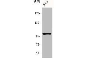 Western Blotting (WB) image for anti-Nuclear Factor of kappa Light Polypeptide Gene Enhancer in B-Cells 1 (NFKB1) (pSer907) antibody (ABIN7182114)