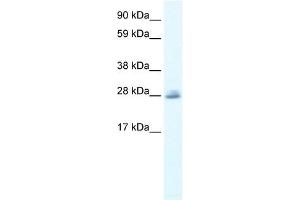 CLIC5 antibody used at 0. (CLIC5 Antikörper  (C-Term))