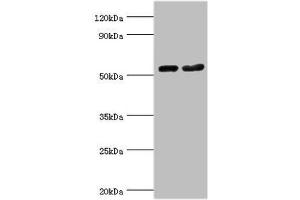 Western blot All lanes: Septin-7 antibody at 9 μg/mL Lane 1: Hela whole cell lysate Lane 2: Mouse gonad tissue Secondary Goat polyclonal to rabbit IgG at 1/10000 dilution Predicted band size: 51 kDa Observed band size: 51 kDa (Septin 7 Antikörper  (AA 308-437))