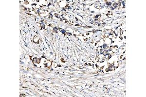 IHC analysis of CPT1A using anti-CPT1A antibody (ABIN7599853). (CPT1A Antikörper  (AA 122-556))