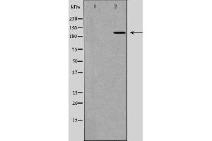 Western blot analysis of Hela whole cell lysates, using UPF1  Antibody. (RENT1/UPF1 Antikörper)
